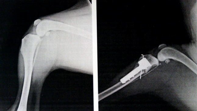 radiografia femur TTA